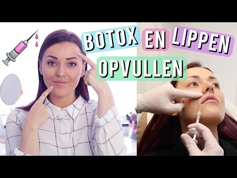 Vloggen over gratis Botox behandeling - Reclamecode Social Media